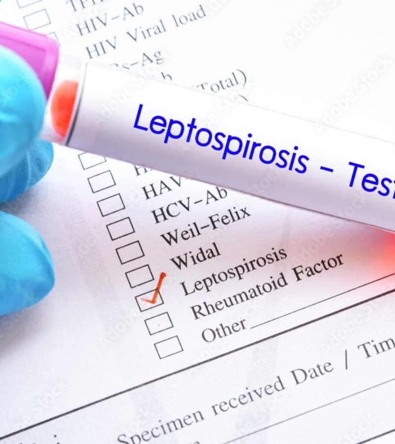 País registra 61% alza casos leptospirosis