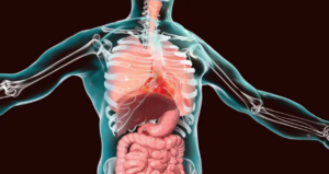 Qué ocurre en el cuerpo humano cuando los órganos están en el lugar equivocado