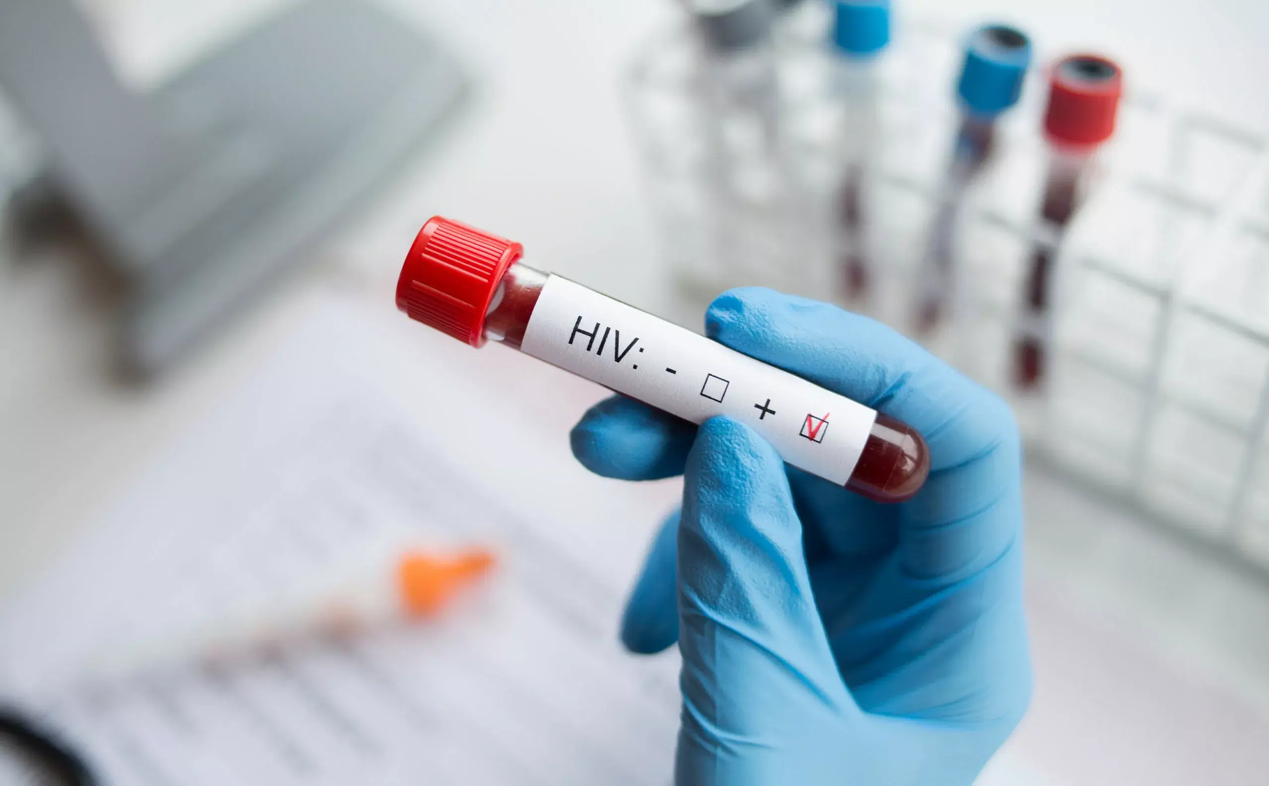 Salud Pública llama a respetar la confidencialidad de diagnósticos de VIH