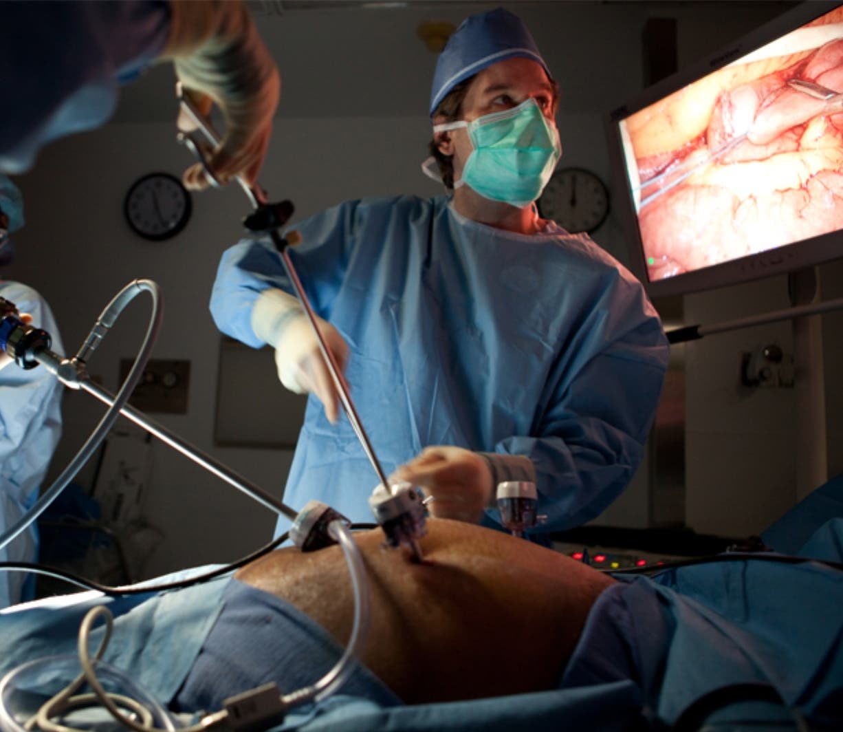 Cirugía bariátrica y sus diferentes enfoques