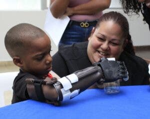 Niños amputados reflejan felicidad al recibir prótesis