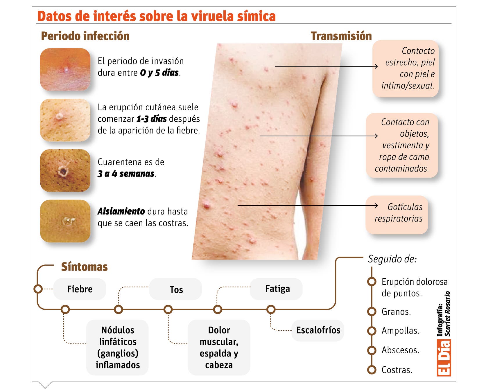 Salud insta a identificar signos viruela símica