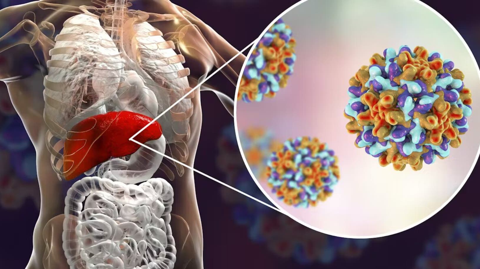 Hepatitis sigue siendo importante problema de salud pública