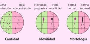 Infertilidad masculina, realidad palpable que afecta a muchas parejas