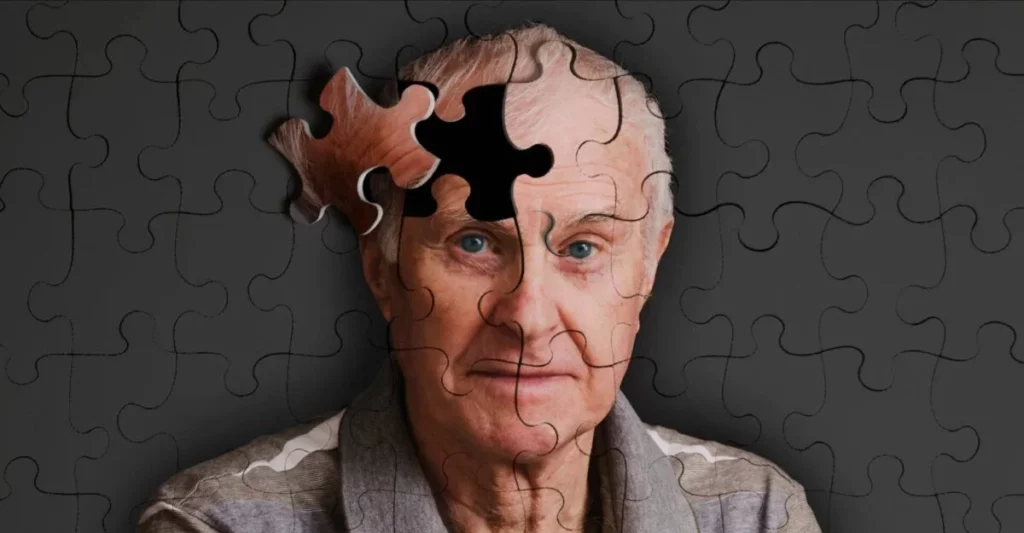 Alzheimer