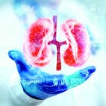 Hemodiálisis: un tratamiento vital para la insuficiencia renal