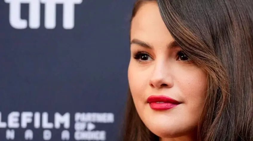 Selena Gómez expuso su rostro al natural con un brote de acné