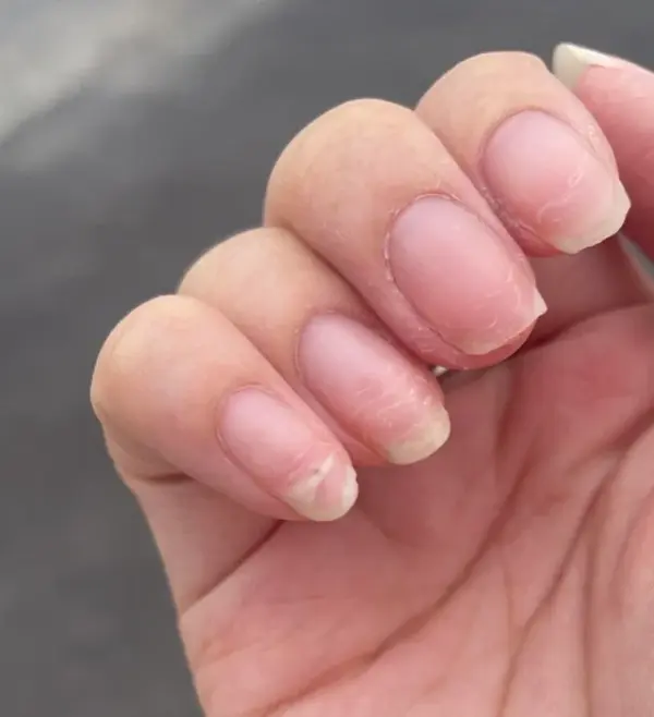weak-nails-after-constantly-using-gel-and-nail-glue-help-v0-omr6gkubsqaa1