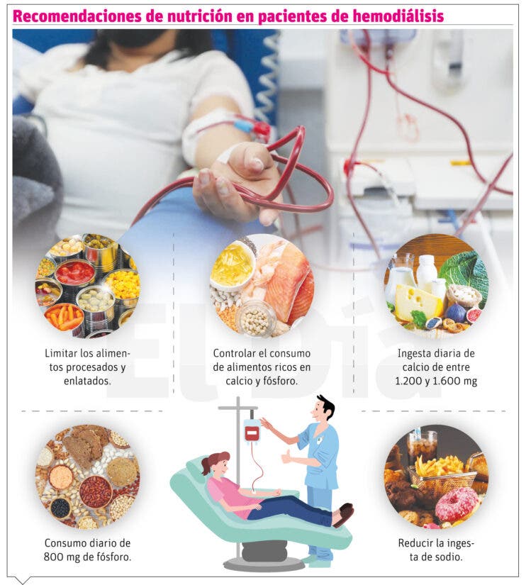 Nutrición de hemodiálisis: un desafío vital para la salud y supervivencia