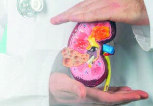 Historia, mitos y avances científicos del trasplante renal