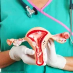 Investigación revela retos del cáncer de cuello uterino y el VPH en República Dominicana