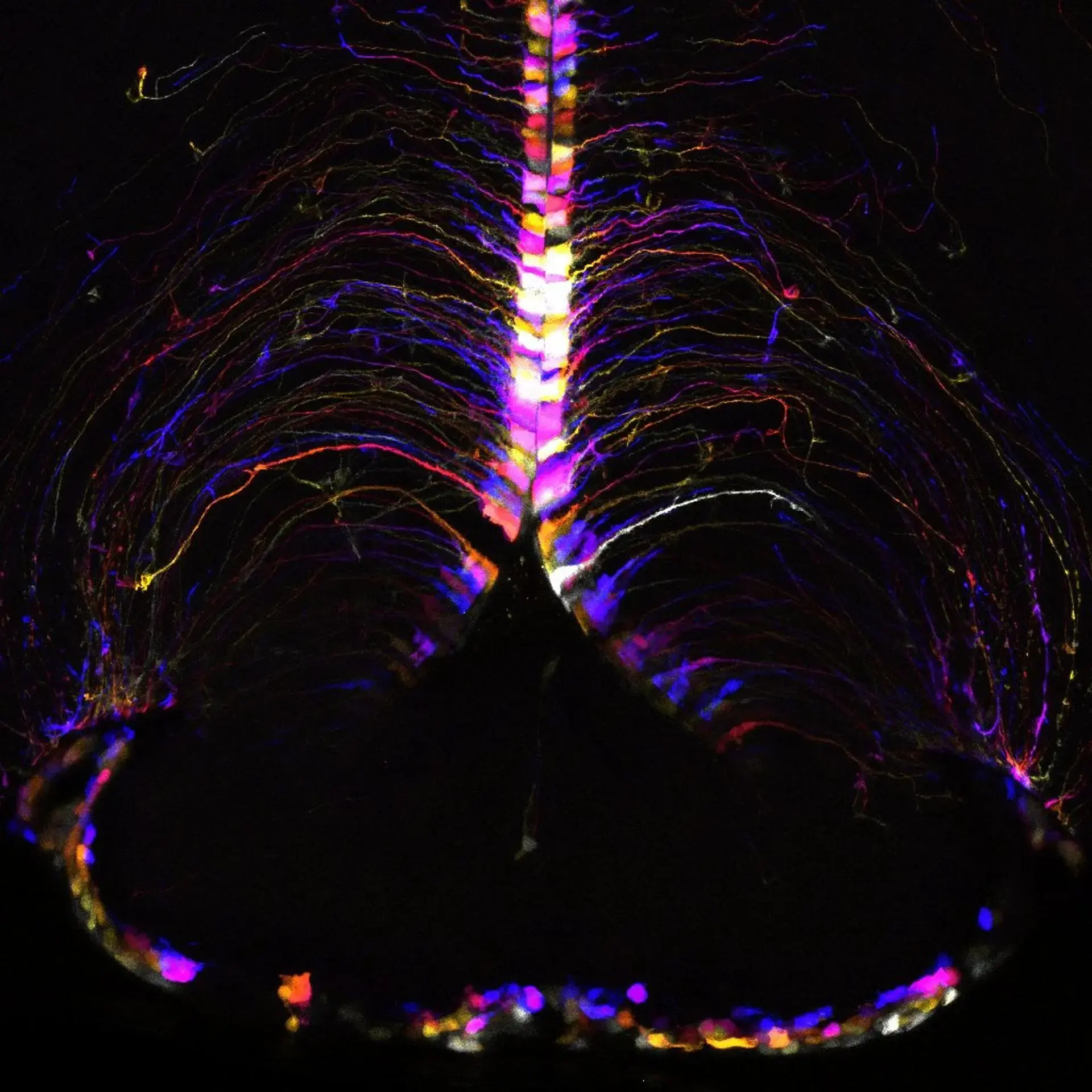 Descubren el ‘punto caliente’ del cerebro donde se produce el envejecimiento