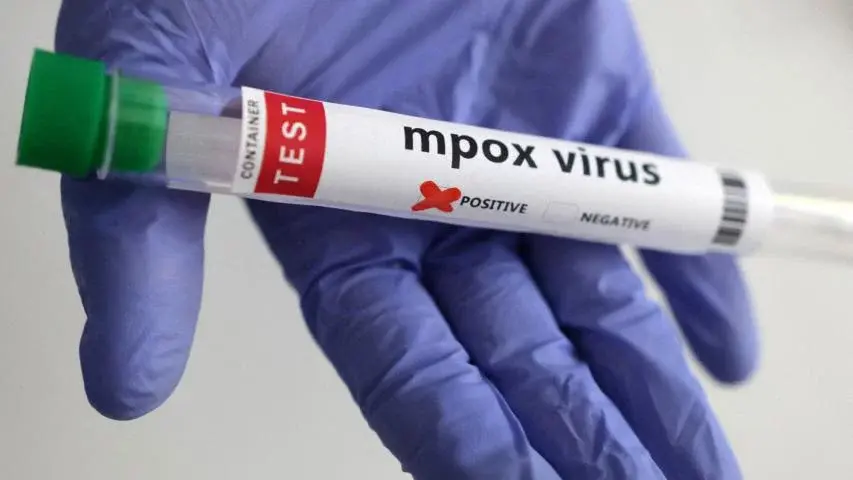 Francia detecta el primer caso del virus de mpox 1b