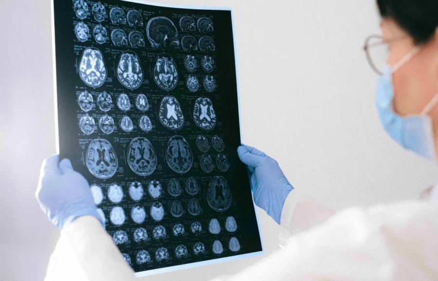 Epilepsia-factores-de-riesgo-1170×752