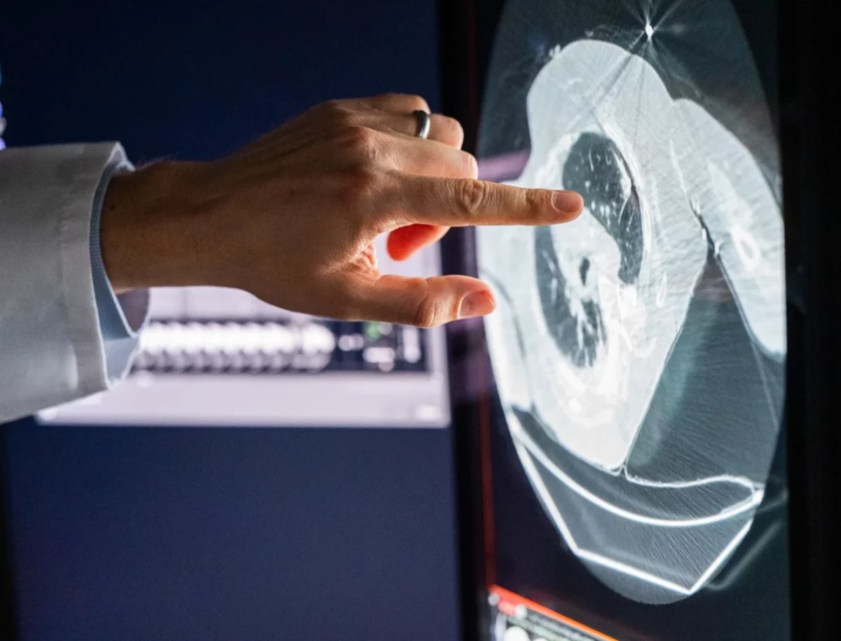 La inmunoterapia fortalece el sistema inmunitario para combatir las células cancerosas.