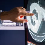 Incart advierte que más de la mitad de los pacientes con cáncer llegan en etapas avanzadas