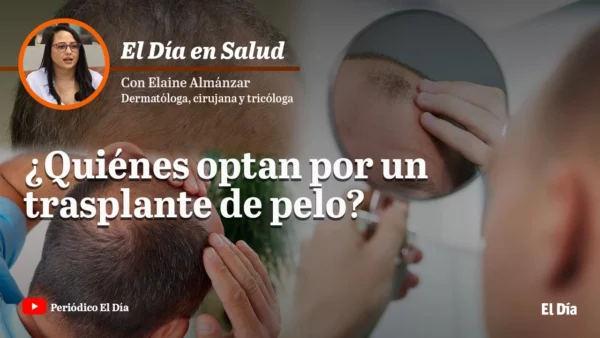 trasplante de pelo plantilla