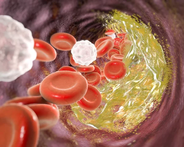 Chequeo médico,  hábitos alimenticios saludables y ejercicios son muy importantes.