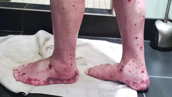 fd07e4_6cdff2e48bff4efc8035a6108a7088d0~mv2