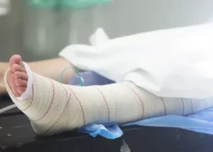 Niña de 8 años rociada con gasolina por otra menor tiene toda la parte izquierda del cuerpo quemada