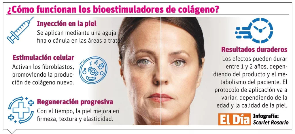 Bioestimuladores son eficaz reafirmar la piel