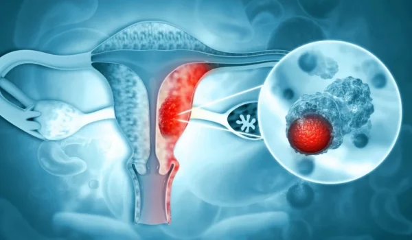La cirugía laparoscópica ginecológica ofrece la ventaja de que las incisiones son muy pequeñas, por lo que en poco tiempo pueden ser casi invisibles.