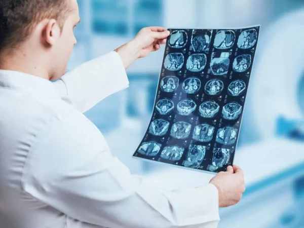 Los radiólogos son los médicos especializados en interpretar las imágenes del interior del cuerpo. Fuente externa