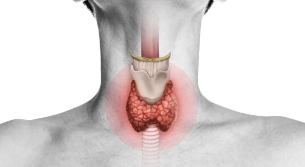 El hipotiroidismo ocurre cuando la tiroides no produce suficiente  hormona tiroidea.