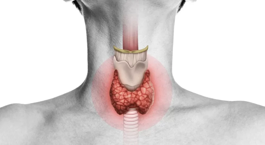 El hipotiroidismo ocurre cuando la tiroides no produce suficiente hormona tiroidea. El hipotiroidismo ocurre cuando la tiroides no produce suficiente hormona tiroidea.