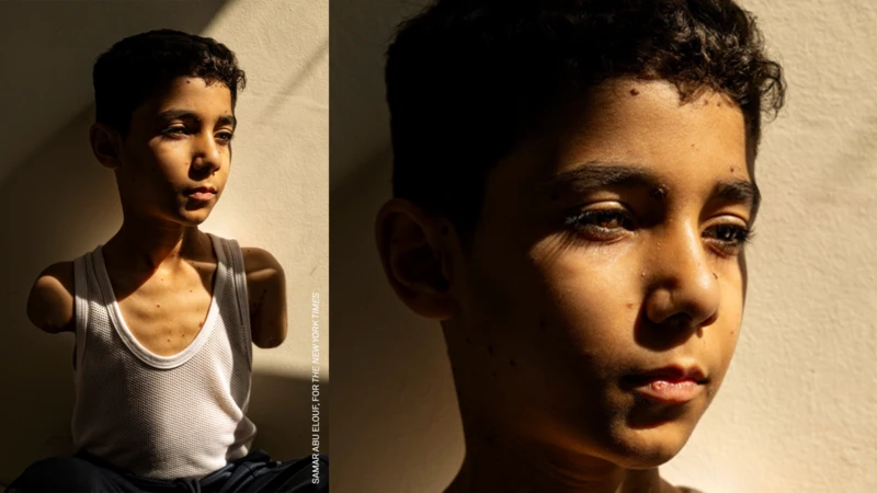 La fotografía de Mahmoud Ajjour hecha por Samar Abu Elouf ganó el World Press Photo 2025.