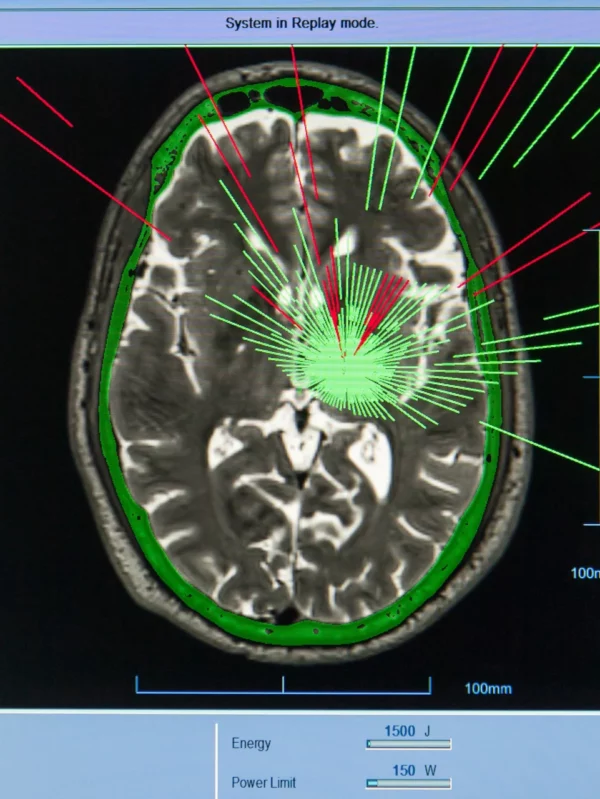 La lucha contra el Párkinson continúa, pero gracias a la ciencia y la tecnología, hoy es posible afrontarla con más esperanza y mejores herramientas.