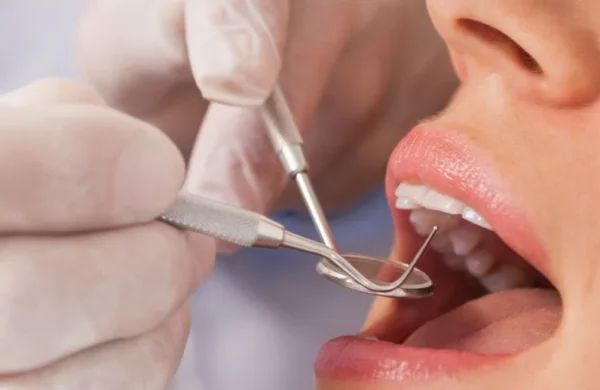 Atender a tiempo los problemas bucales es fundamental.