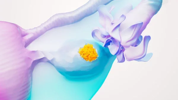 Cáncer de ovario: lo que debes saber hoy sobre detección temprana y tratamientos que salvan vidas