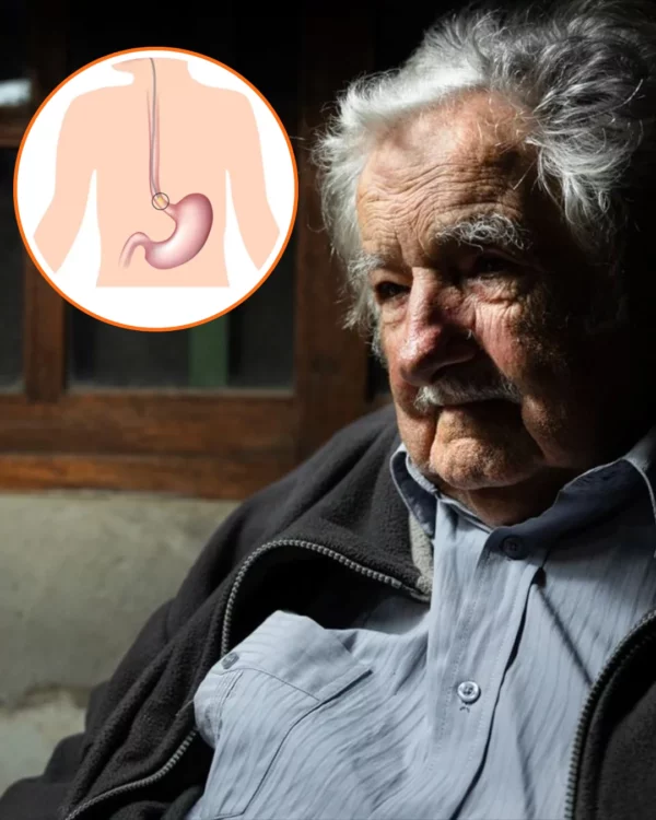 Muere Pepe Mujica: el cáncer de esófago, una enfermedad común en hombres mayores