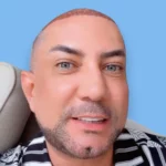 Marcos Yaroide habla sobre su trasplante de pelo: "No me dejaré caer a mis 50″