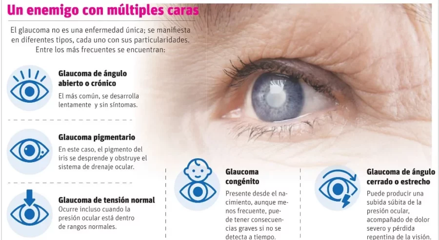 glaucoma glaucoma