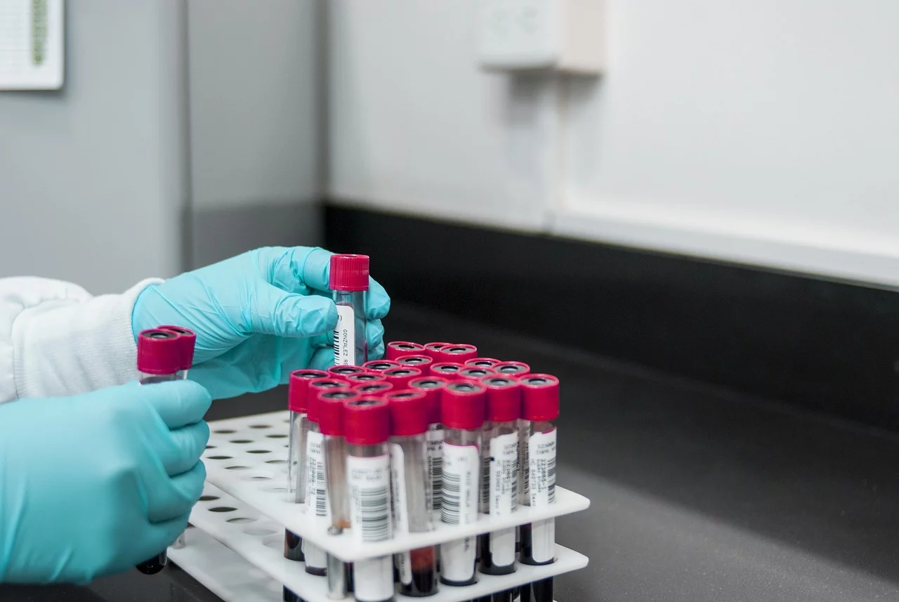 Mayo Clinic confirma precisión de prueba de sangre para detectar Alzheimer con 95% de sensibilidad