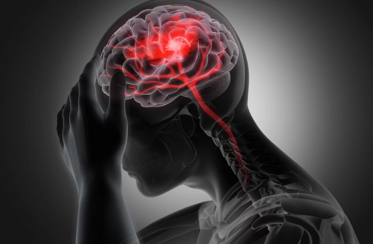 República Dominicana avanza hacia la creación del primer centro especializado en atender accidentes cerebrovasculares