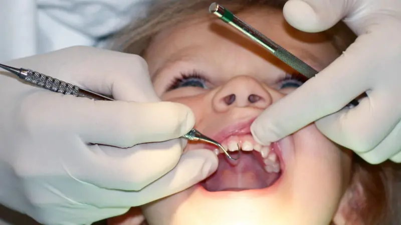 La fluoración del agua ha tenido un impacto particularmente visible en la salud dental de los niños en zonas con dificultad de acceso a crema de dientes con flúor. La fluoración del agua ha tenido un impacto particularmente visible en la salud dental de los niños en zonas con dificultad de acceso a crema de dientes con flúor.