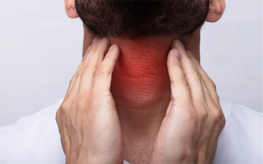 Cáncer de cabeza y cuello: signos de alerta y cómo apoyar a un ser querido Cáncer de cabeza y cuello: signos de alerta y cómo apoyar a un ser querido