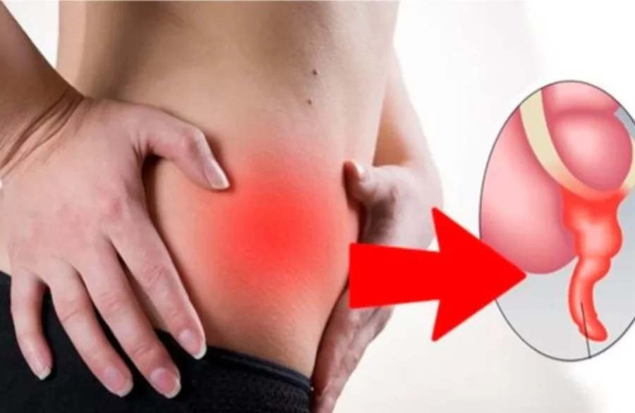 Dolor abdominal que persiste de 6 a 12 horas y se intensifica debe ser evaluado de inmediato. Dolor abdominal que persiste de 6 a 12 horas y se intensifica debe ser evaluado de inmediato.