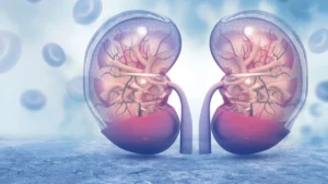 Cáncer renal