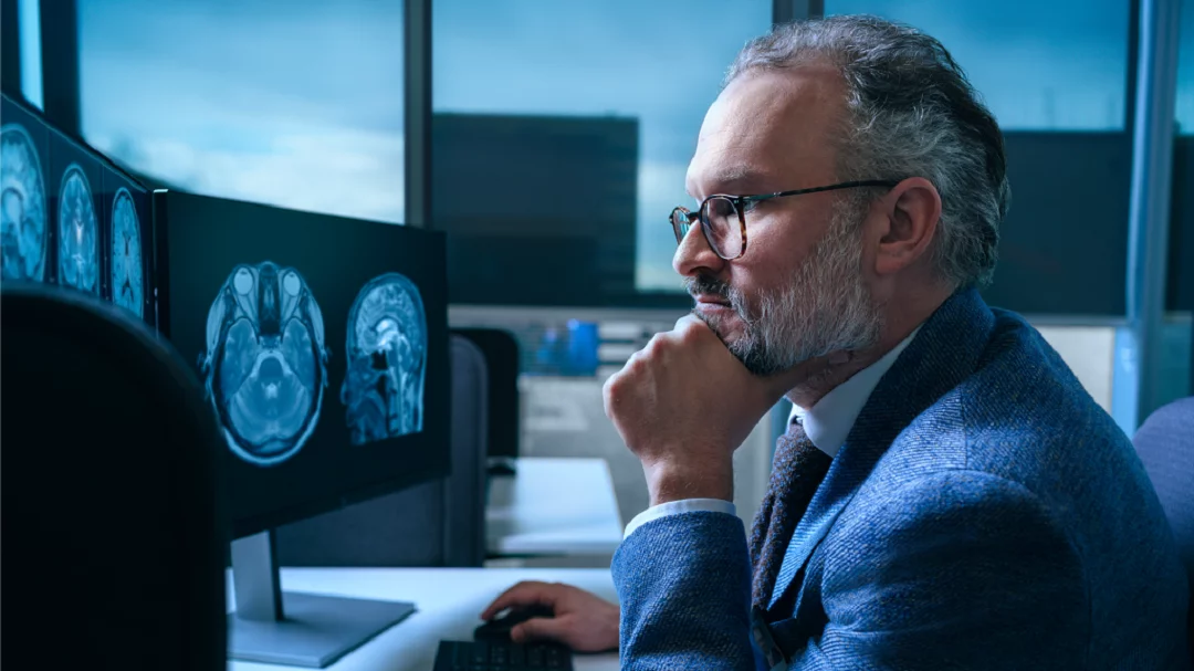 Inteligencia artificial de Mayo Clinic revoluciona el diagnóstico temprano de nueve tipos de demencia