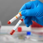 Hemocentro revela que país se coloca en la octava posición de 21 países donantes de sangre