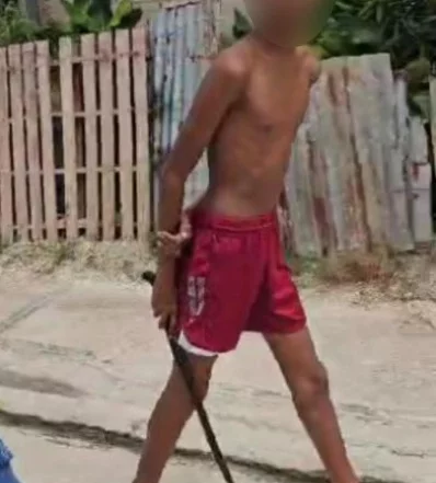 Una persona se hizo de un arma blanca en la acción.