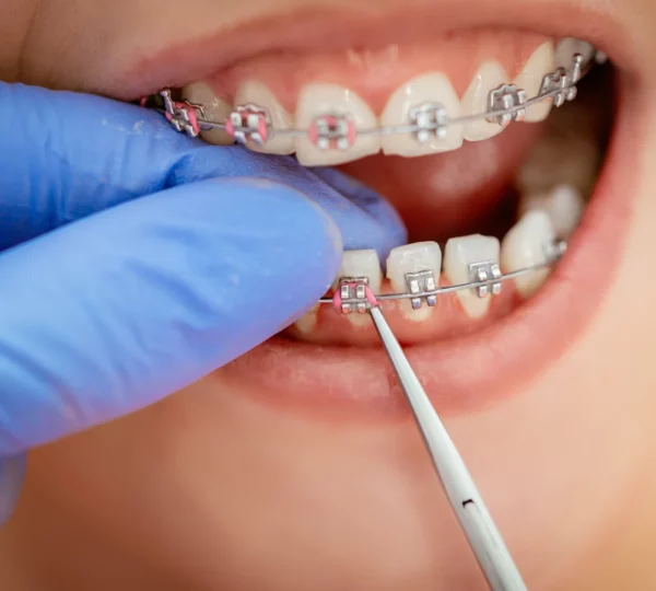 Lo más importante es contar con una correcta valoración profesional.