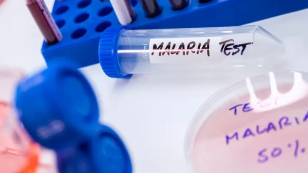 Los cinco casos confirmados de malaria corresponden al municipio Guayabal en Azua.