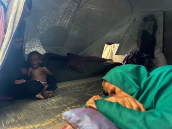 En la imagen, un niño desnutrido en Gaza.