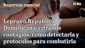 ¿Qué es la lepra?