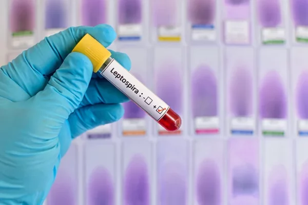 Aumentan casos de leptospirosis en RD: jóvenes adultos y hombres, los más afectados.